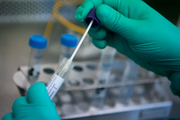 Osam preminulih u RS, virus potvrđen kod 134 osobe