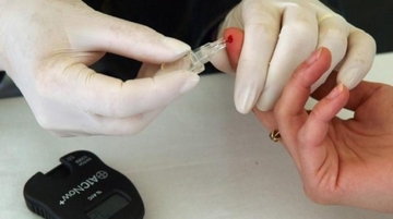 Bijeljina: Trista građana besplatno provjerilo nivo šećera i krvni pritisak