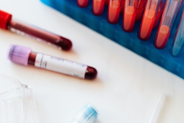  Šta je flurona i koji su najčešći simptomi?