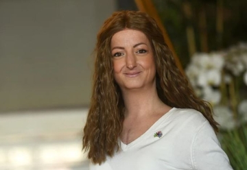 Ivana boluje od bolesti brzog starenja: Ima 35 godina i ZAROBLJENA JE U TIJELU STARICE