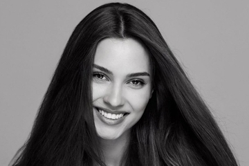 Preminula ruska manekenka: Jelen joj polomio lobanju (FOTO)