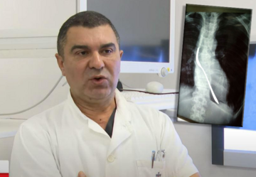 "Gutaju viljuške, opruge, federe iz kreveta" Hirurg iz Urgentnog centra objasnio šta sve IZVUKU IZ PACIJENATA