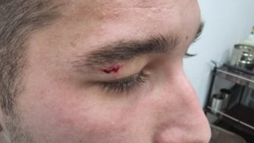 Srbin iz Zubinog Potoka: Specijalci ROSU maltretirali sina i mene, izuli nas i držali u kanalu