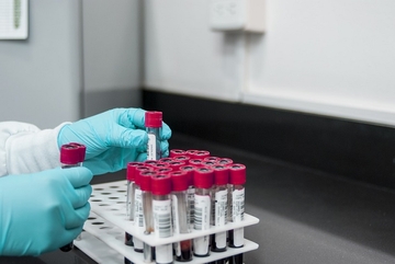 Na virus korona pozitivne 32 osobe u Srpskoj, preminulo 5 zaraženih