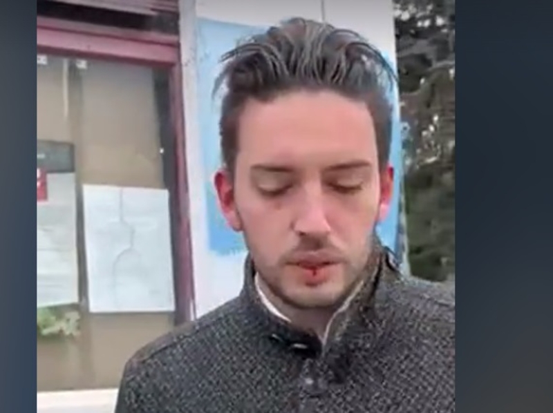 Pretučen lider PSG, Grboviću razbijena glava u blizini biračkog mjesta (VIDEO)